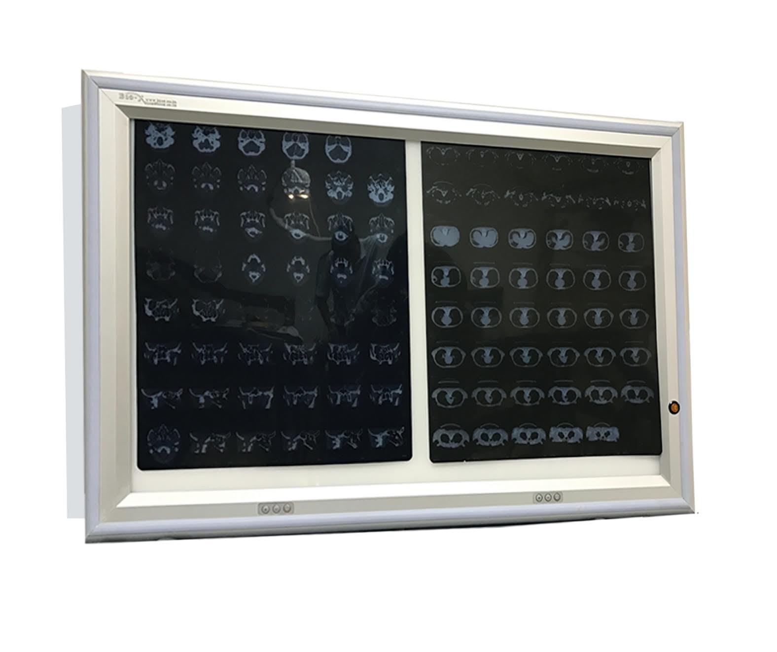 X ray viewer